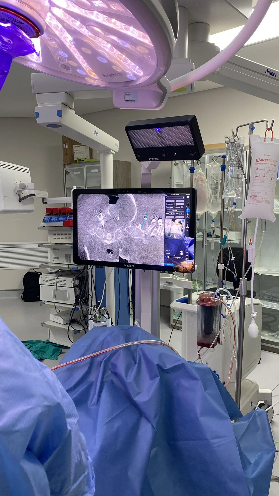 Augmented Reality in Neurosurgery: Transforming Precision and Patient Outcomes