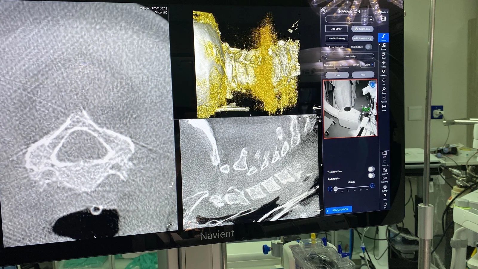 NAVIENT Navigation Cart